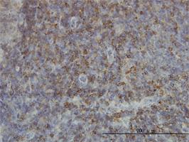 Anti-SH2D3C Mouse Monoclonal Antibody [clone: 3B2]