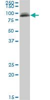 Anti-PIGS Mouse Monoclonal Antibody [clone: 3F3]