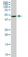 Anti-UGP2 Mouse Monoclonal Antibody [clone: 3H3]