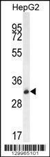 Anti-OR4K5 Rabbit Polyclonal Antibody (APC (Allophycocyanin))