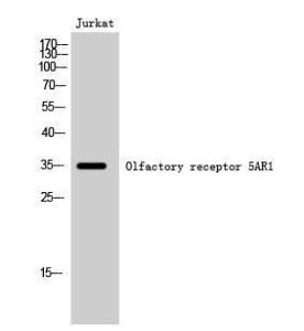 Western blot analysis of Jurkat cells using Anti-OR5AR1 Antibody