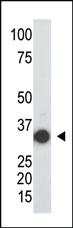 Anti-SULT2A Rabbit Polyclonal Antibody