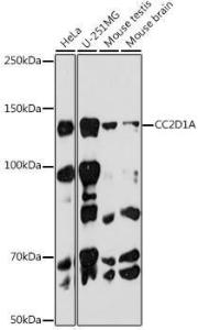 Anti-CC2D1A Rabbit Monoclonal Antibody [clone: ARC2464]