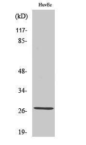 Western blot analysis of various cells using Anti-ANP32C Antibody