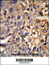 Anti-HSD17B12 Rabbit Polyclonal Antibody