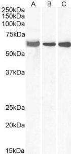 Anti-ELF1 Antibody (A83273) (0.3 µg/ml) staining of Human Lymph Node (A), Human Tonsil (B) and Mouse Thymus (C) lysates (35 µg protein in RIPA buffer). Primary incubation was 1 hour. Detected by chemilu minescence