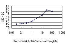 Anti-FCMR Mouse Monoclonal Antibody [clone: 1E4]