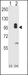 Anti-PRKG2 Rabbit Polyclonal Antibody (APC (Allophycocyanin))