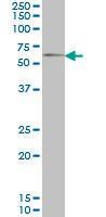 Anti-GGT1 Mouse monoclonal antibody [clone: 1F9]