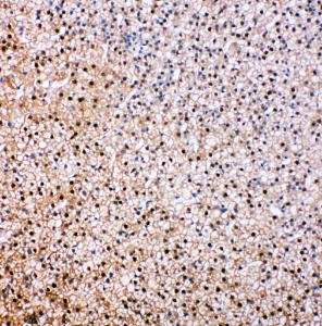 Anti-VCP Rabbit Polyclonal Antibody