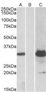 HEK293 lysate (10ug protein in RIPA buffer) overexpressing Human KCTD11 with DYKDDDDK tag probed with Anti-KCTD11 Antibody (A84889) (1.0 µg/ml) in Lane A and probed with anti-DYKDDDDK Tag (1/5000) in lane C