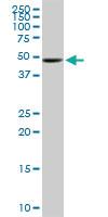 Anti-UGP2 Mouse Monoclonal Antibody [clone: 3H3]