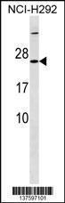 Anti-MRPS23 Rabbit Polyclonal Antibody (APC (Allophycocyanin))