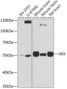 Western blot analysis of extracts of various cell lines, using Anti-Arx Antibody (A92983) at 1:1,000 dilution