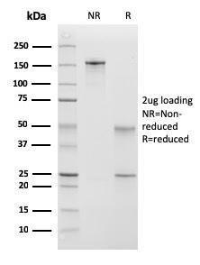 SDS-PAGE analysis of Anti-Calponin 1 Antibody [CNN1/832 + CALP] under non-reduced and reduced conditions; showing intact IgG and intact heavy and light chains, respectively. SDS-PAGE analysis confirms the integrity and purity of the Antibody