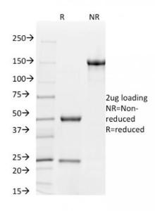 SDS-PAGE analysis of Anti-CD31 Antibody [C31.7] under non-reduced and reduced conditions; showing intact IgG and intact heavy and light chains, respectively. SDS-PAGE analysis confirms the integrity and purity of the antibody.