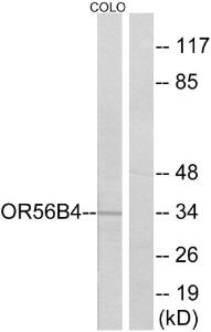 Western blot analysis of lysates from COLO cells using Anti-OR56B4 Antibody. The right hand lane represents a negative control, where the Antibody is blocked by the immunising peptide