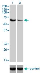 Anti-UGP2 Mouse Monoclonal Antibody [clone: 3H3]