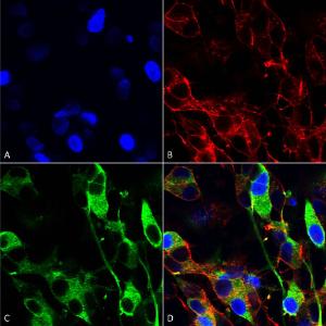 Immunocytochemistry/Immunofluorescence analysis of human neuroblastoma cells (SH-SY5Y), fixed in 4% PFA for 15 min, using Anti-Versican Antibody [S351-23] (A305042), at 1:200 for overnight at 4°C with slow rocking