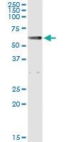 Anti-ALDH1A1 Antibody Pair