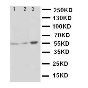 Anti-PKM2 Rabbit Polyclonal Antibody