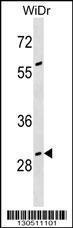 Anti-GAS2 Rabbit Polyclonal Antibody (HRP (Horseradish Peroxidase))