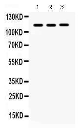 Anti-ITGA2B Rabbit Polyclonal Antibody