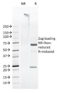 Anti-FAT1 antibody