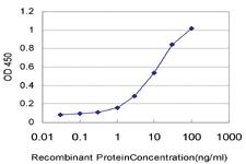 Anti-UGP2 Mouse Monoclonal Antibody [clone: 3H3]