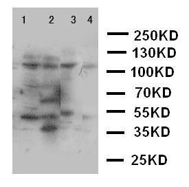 Anti-Phospholipase A2 Rabbit Polyclonal Antibody