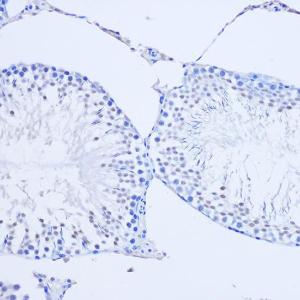 Immunohistochemistry analysis of paraffin-embedded rat testis using Anti-Arx Antibody (A92983) at a dilution of 1:50 (20x lens). Perform microwave antigen retrieval with 10 mM PBS buffer pH 7.2 before commencing with IHC staining protocol