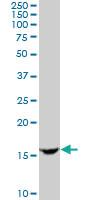 Anti-TCL1A Goat Polyclonal Antibody