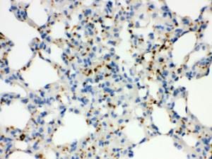 Anti-ITGA2B Rabbit Polyclonal Antibody