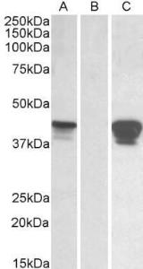 HEK293 lysate (10ug protein in RIPA buffer) overexpressing Human SLAMF8 with C-terminal MYC tag probed with Anti-SLAMF8 Antibody (A84892) (0.01µg/ml) in Lane A and probed with anti-MYC Tag (1/1000) in lane C