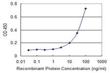 Anti-DIAPH3 Mouse Monoclonal Antibody [clone: 4D5]