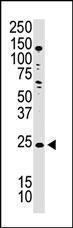 Anti-PDPN Rabbit Polyclonal Antibody (APC (Allophycocyanin))