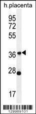 Anti-OR4L1 Rabbit Polyclonal Antibody (HRP (Horseradish Peroxidase))