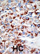 Anti-UBA3 Rabbit Polyclonal Antibody (Biotin)