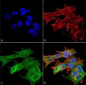 Immunocytochemistry/Immunofluorescence analysis of human neuroblastoma cell line (SK-N-BE, fixed in 4% formaldehyde for 15 min at room temperature, using Anti-Versican Antibody [S351-23] (A305042), at 1:100 for 60 minutes at room temperature