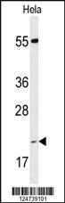 Anti-PPIC Rabbit Polyclonal Antibody