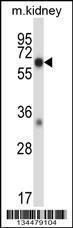 Anti-MAP3K2 Rabbit Polyclonal Antibody (FITC (Fluorescein Isothiocyanate))