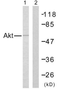 Western blot analysis of lysates from Jurkat cells, treated with H2O2 using Anti-Akt Antibody The right hand lane represents a negative control, where the antibody is blocked by the immunising peptide