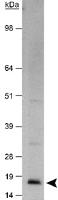 Anti-CDKN2A Rabbit Polyclonal Antibody