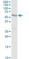 Anti-TBL2 Rabbit Polyclonal Antibody