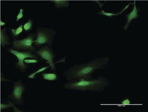 Anti-UGT2B4 Mouse Monoclonal Antibody [clone: 2H6]