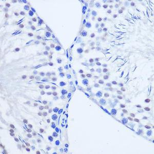 Immunohistochemistry analysis of paraffin-embedded rat testis using Anti-Arx Antibody (A92983) at a dilution of 1:50 (40X lens). Perform microwave antigen retrieval with 10 mM PBS buffer pH 7.2 before commencing with IHC staining protocol