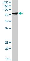 Anti-HSPA1L Rabbit Polyclonal Antibody