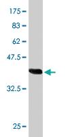 Anti-CPSF6 Mouse Monoclonal Antibody [clone: 1C5]