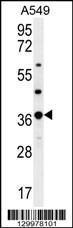 Anti-OR4M1 Rabbit Polyclonal Antibody (AP (Alkaline Phosphatase))