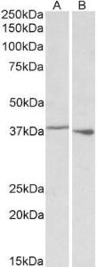 Anti-PCBP1 antibody